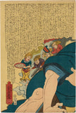 Yoshikatsu: Medical Image of Man Receiving Moxibustion Treatment; Profound Adivice of Harmonious Unity of Five Body Parts